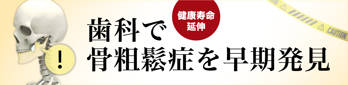 歯科で骨粗鬆症を早期発見ページへ
