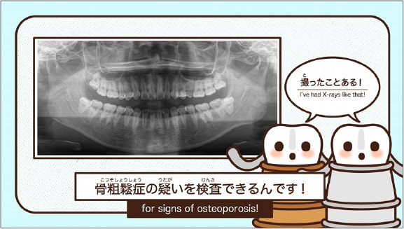 歯科×AIで骨粗鬆症のリスクチェック