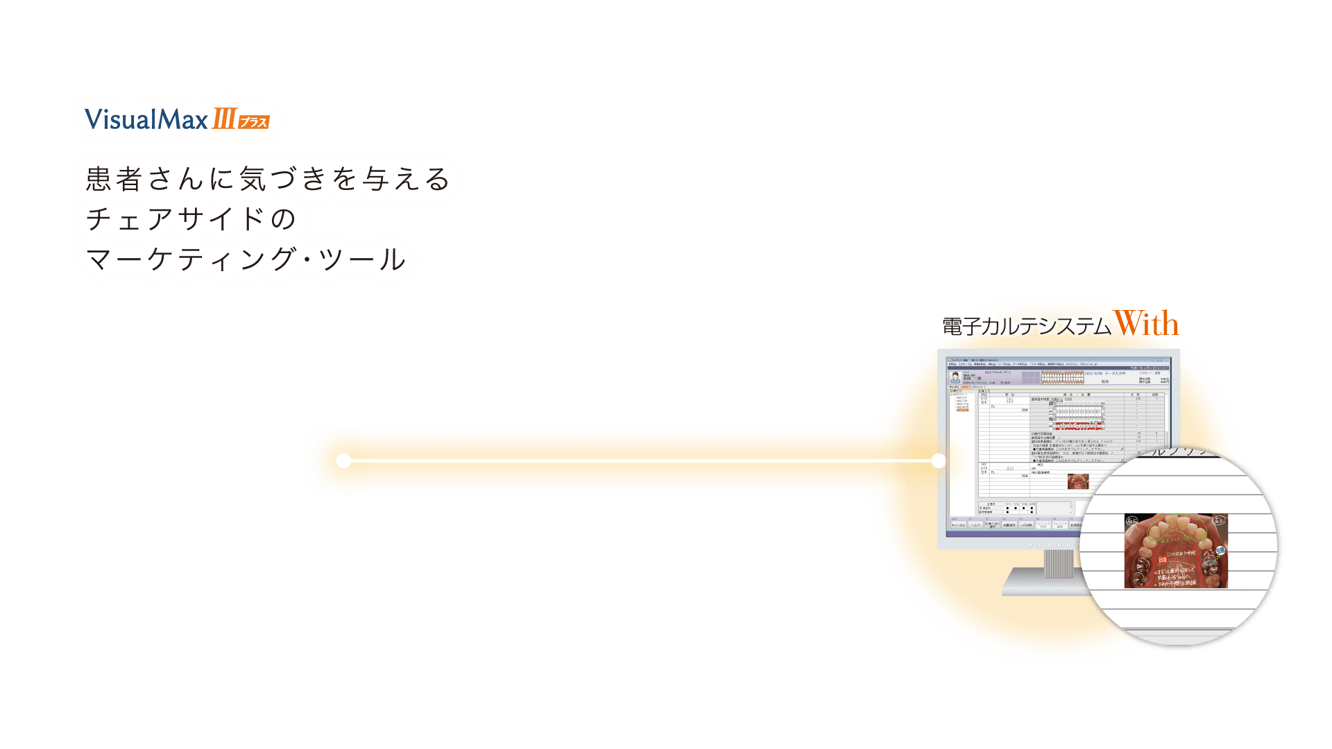 Visual Max Ⅲ プラス 患者さんに気づきを与えるチェアサイドのマーケティング・ツール