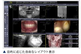 目的に応じた自由なレイアウト表示