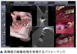 画像キャプション