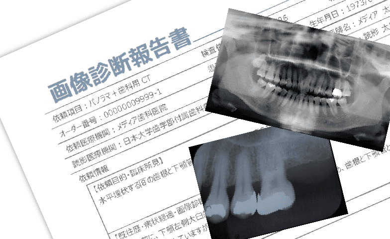 歯科遠隔画像診断支援システム