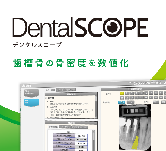 DentalSCOPE